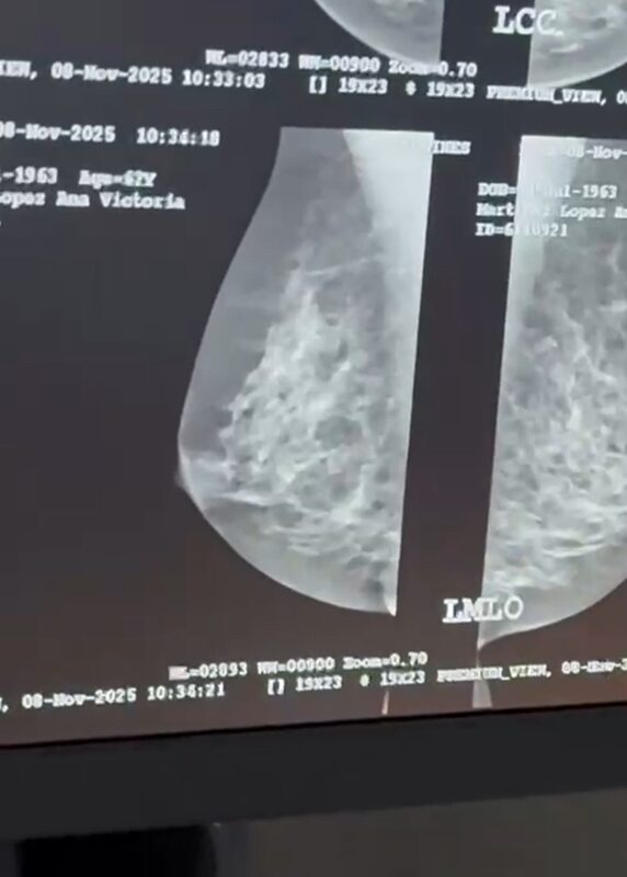 Jornada de Detección Temprana de Cáncer de Mama