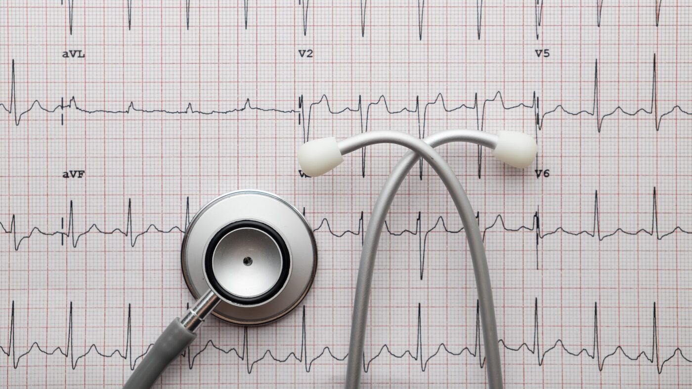 Electrocardiograma