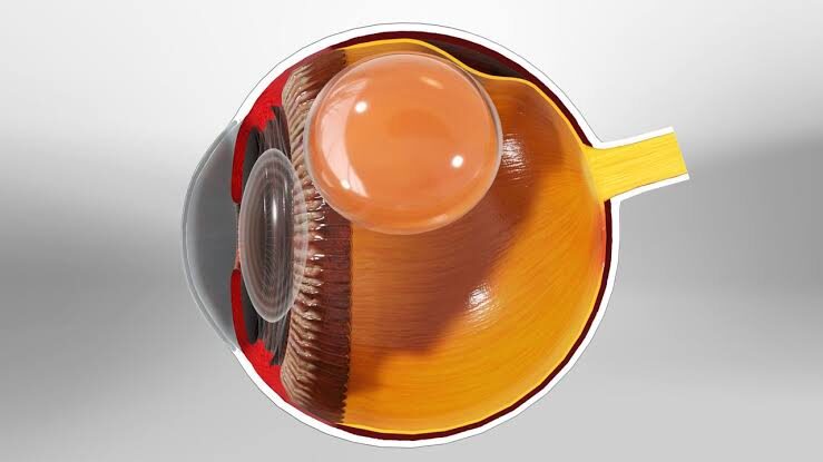 Retina y Vítreo