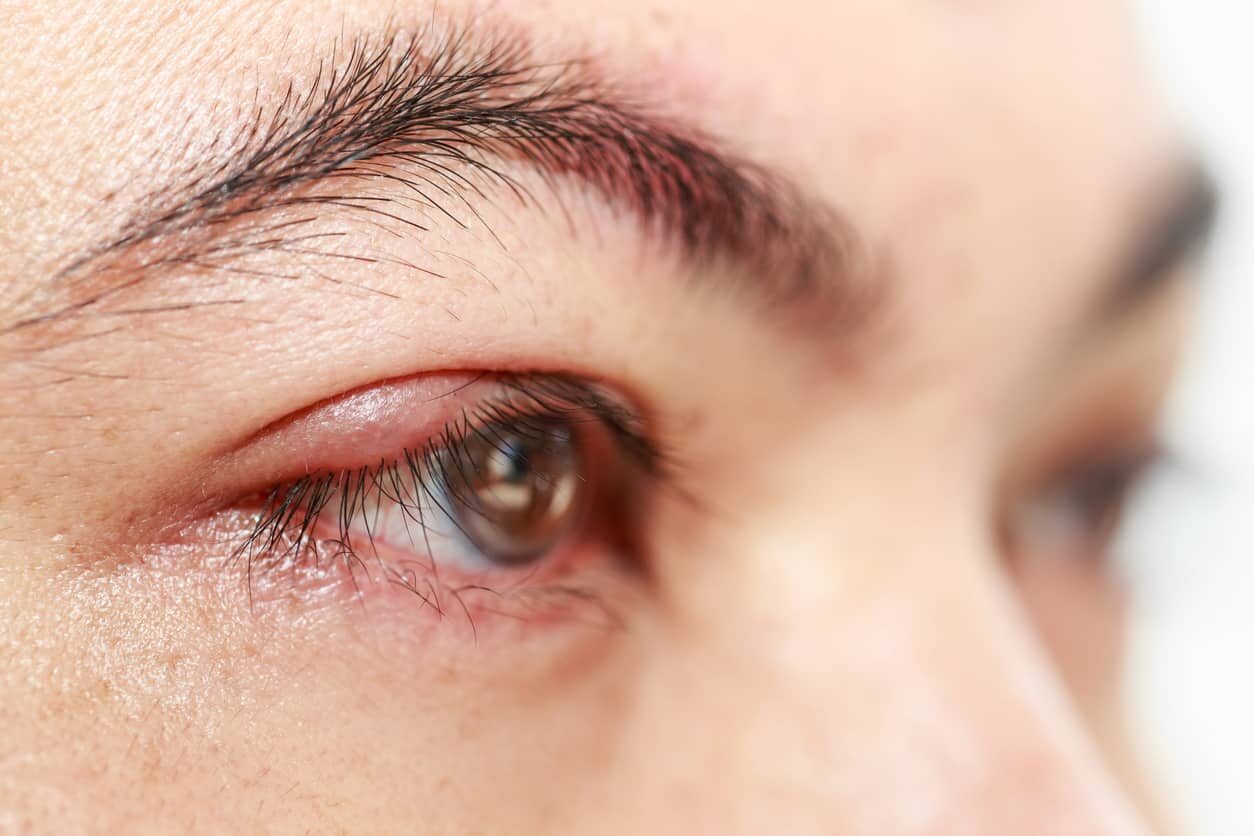 Órbita y Oculoplastia